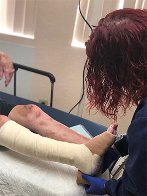 Wrapping wounded leg